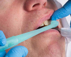 Intersurgical oral care