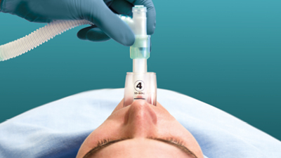 Gestion des Voies Aériennes