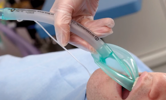 Gamme de masques laryngés Intersurgical